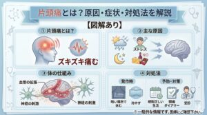片頭痛とは？原因・症状・対処法を図解で解説したイラスト
